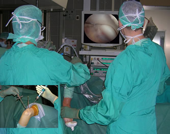 Fig. 2: Elbow arthroscopy during intervention