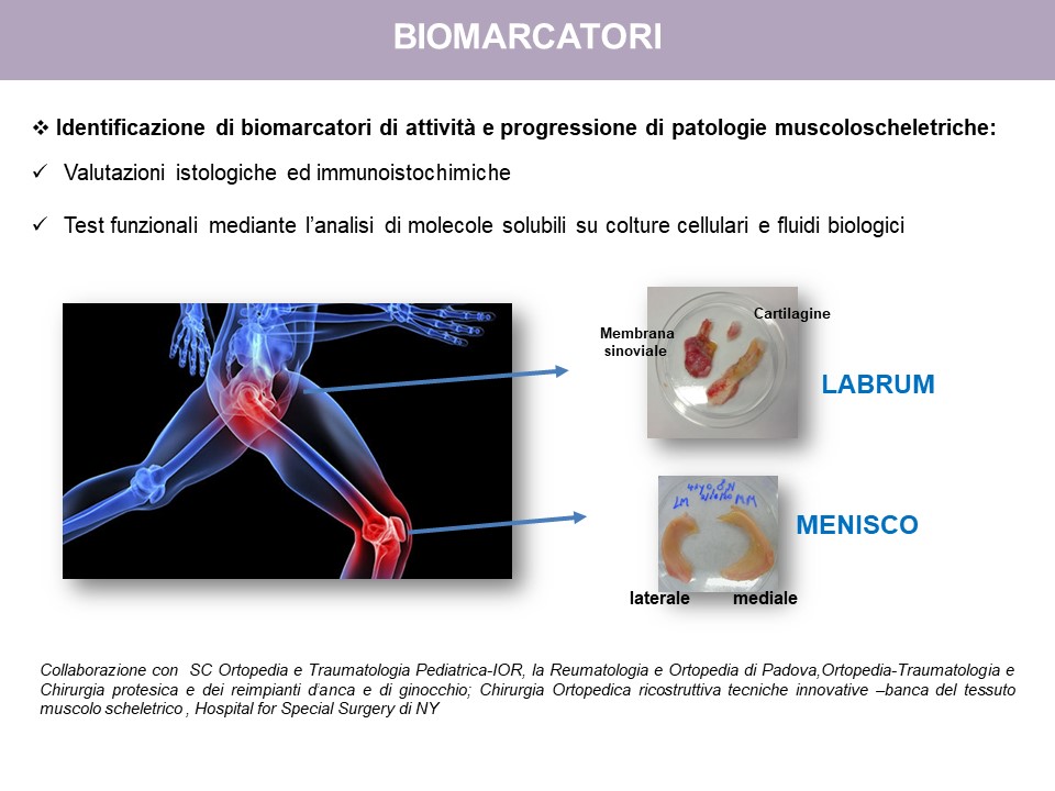 Figura 8: Identificazione di biomarcatori di attività e progressione di patologie muscoloscheletriche