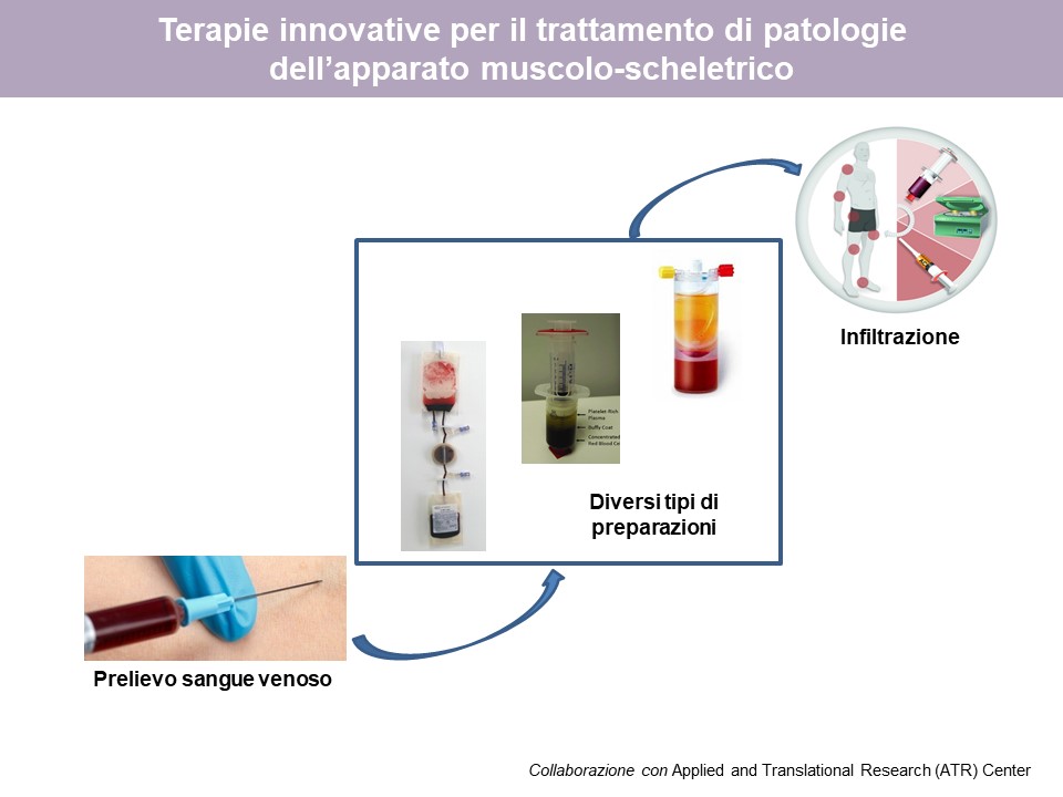 Figura 2: Caratterizzazione di composti biologici (PRP, PRF, APS) e loro attività su colture di cellule (condrociti, sinoviociti, cellule mesenchimali)