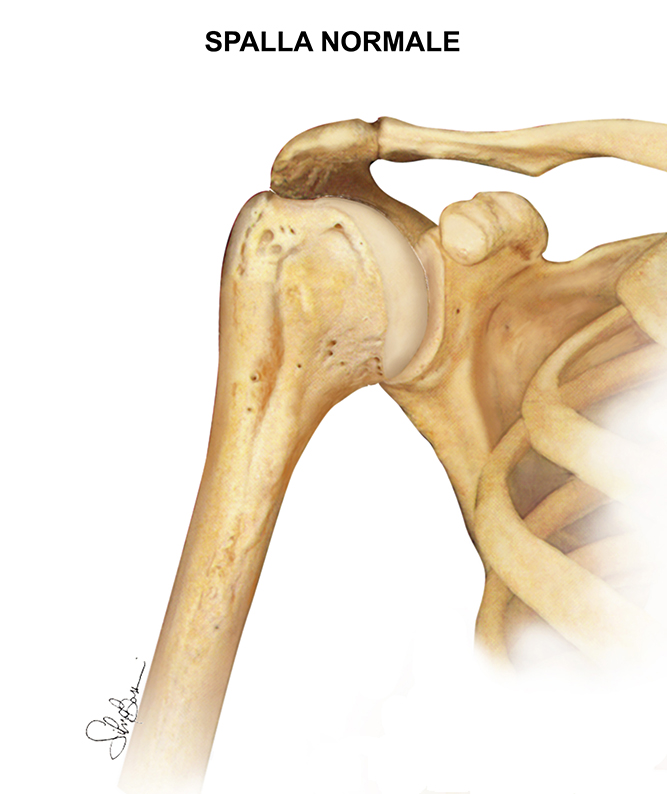 Fig. 4 - Spalla normale